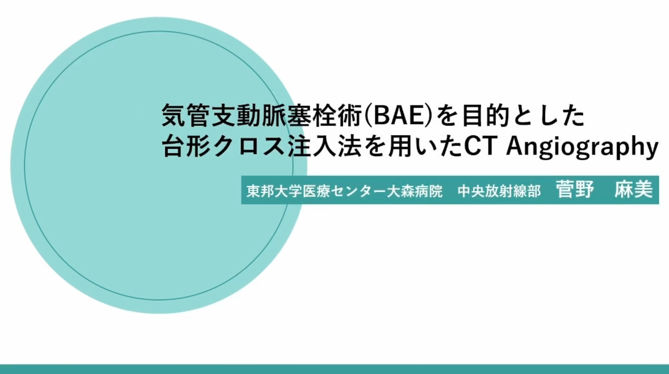 「気管⽀動脈塞栓術(BAE)を⽬的とした台形クロス注⼊法を⽤いたCT Angiography 」